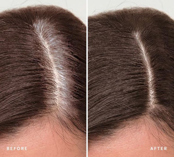 Hair Root touch up